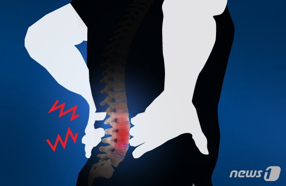 척추관 협착증은 신경이 지나가는 통로인 척추관이 좁아지면서 그 안의 신경을 압박해 통증과 저림, 보행 장애 등을 유발하는 질환이다. /뉴스1