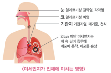미세먼지가 인체에 미치는 영향. ⓒ그래픽 환경부 수도권대기환경청