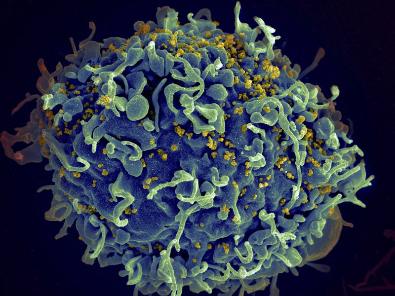 전자현미경 색채화 사진으로 인간 T세포(푸른색)이 에이즈 발병의 HIV 바이러스(노란색) 공격을 받고 있다. 사진=뉴시스(미국 국립보건원 제공)