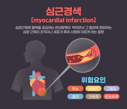 심근경색. 그래픽=게티이미지뱅크