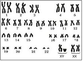 인간의 염색체. 사진=온라인 커뮤니티