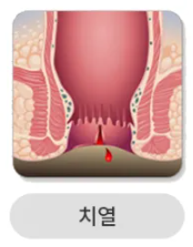 치열. 사진=보건복지부