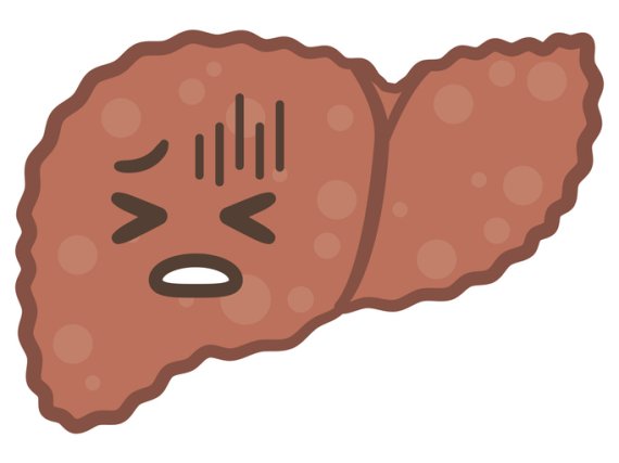 간 기능이 떨어진 상태에서 검증되지 않은 약이나 건강즙, 건강기능식품 등을 전문가 상담 없이 복용하는 경우, 간 독성으로 인해 간경변으로 악화할 가능성이 높다. 사진=게티이미지뱅크