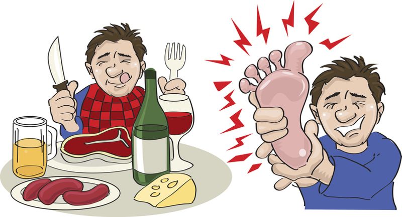기름진 음식 섭취와 과도한 음주는 통풍 발병 위험을 높인다. 통풍이 의심된다면 전문의 상담을 받는 것이 좋다. /게티이미지뱅크